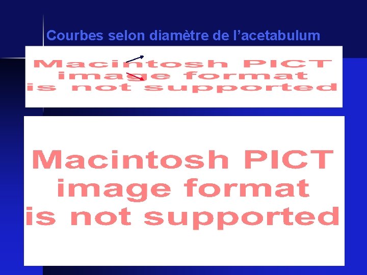 Courbes selon diamètre de l’acetabulum 