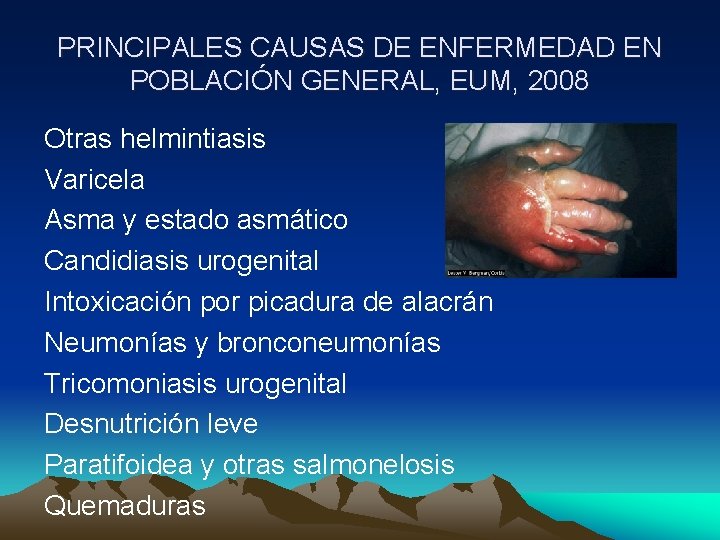 PRINCIPALES CAUSAS DE ENFERMEDAD EN POBLACIÓN GENERAL, EUM, 2008 Otras helmintiasis Varicela Asma y