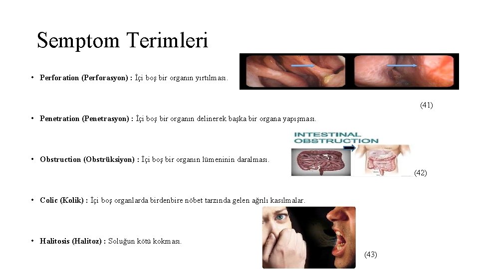 Semptom Terimleri • Perforation (Perforasyon) : İçi boş bir organın yırtılması. (41) • Penetration