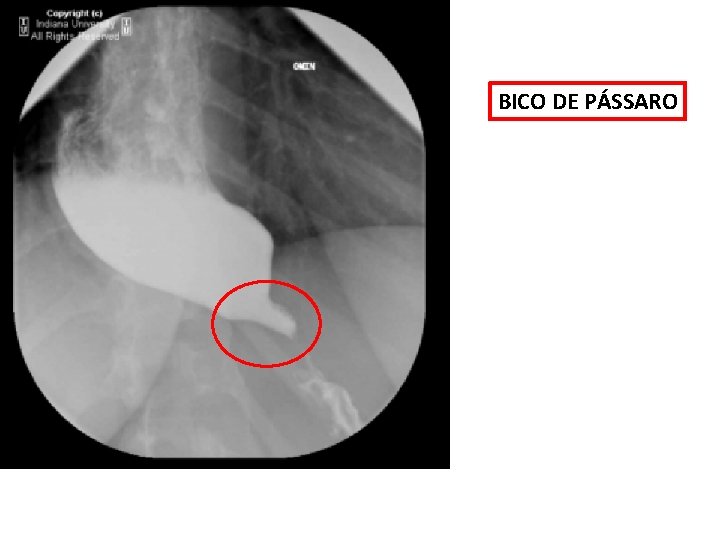BICO DE PÁSSARO BICO DE PÁSSARO