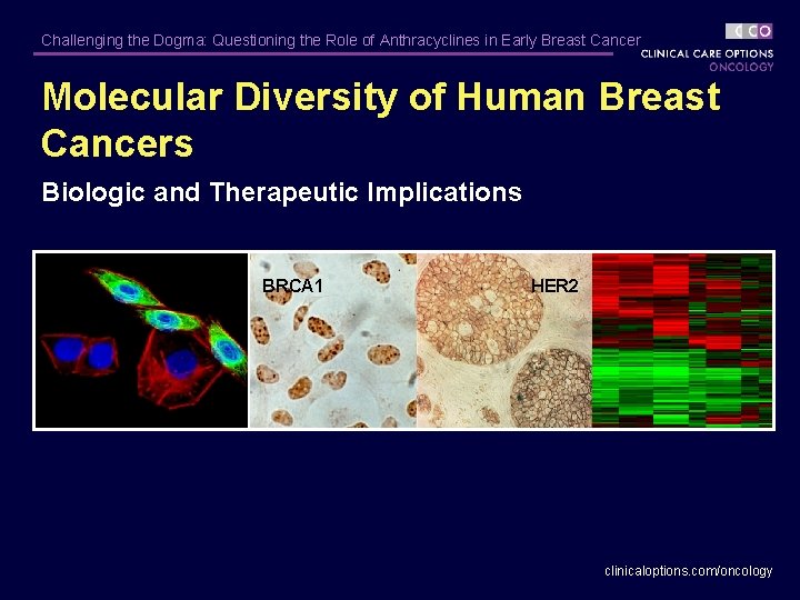 Challenging the Dogma: Questioning the Role of Anthracyclines in Early Breast Cancer Molecular Diversity