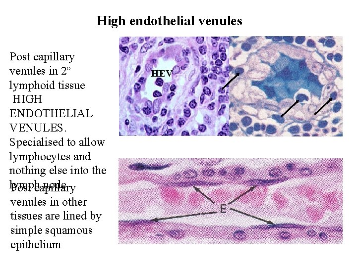 High endothelial venules Post capillary venules in 2º lymphoid tissue HIGH ENDOTHELIAL VENULES. Specialised