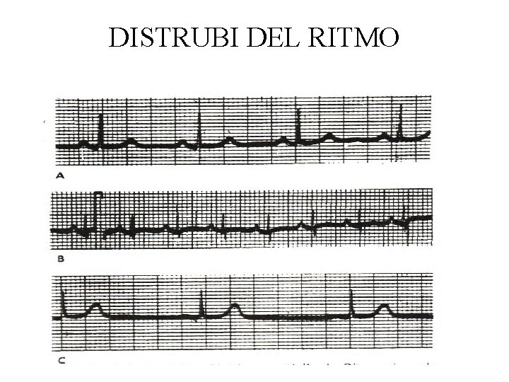 DISTRUBI DEL RITMO 