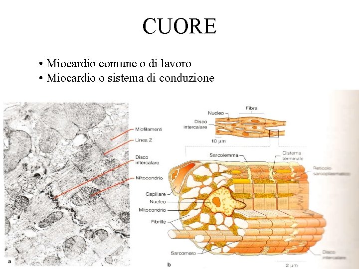CUORE • Miocardio comune o di lavoro • Miocardio o sistema di conduzione 