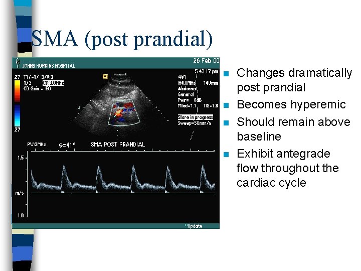SMA (post prandial) n n Changes dramatically post prandial Becomes hyperemic Should remain above