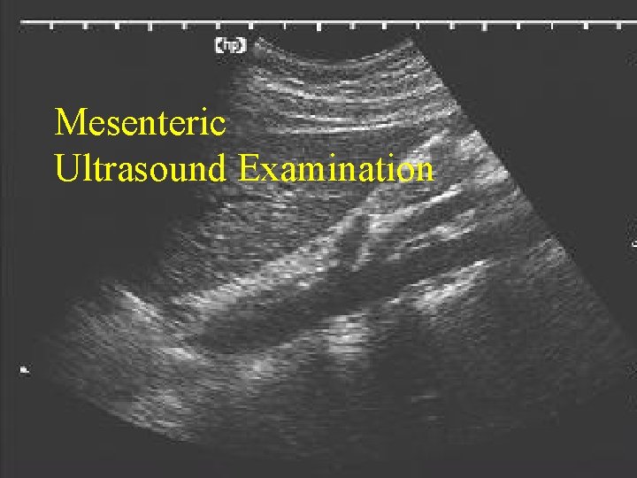 Mesenteric Ultrasound Examination 