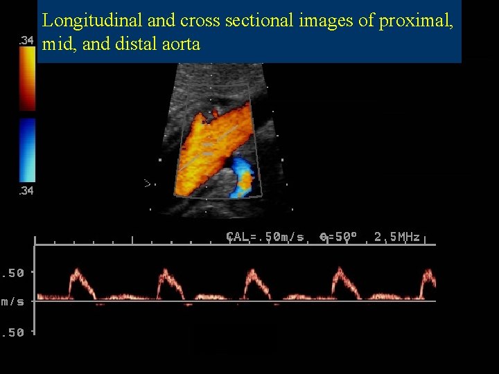 Longitudinal and cross sectional images of proximal, mid, and distal aorta 