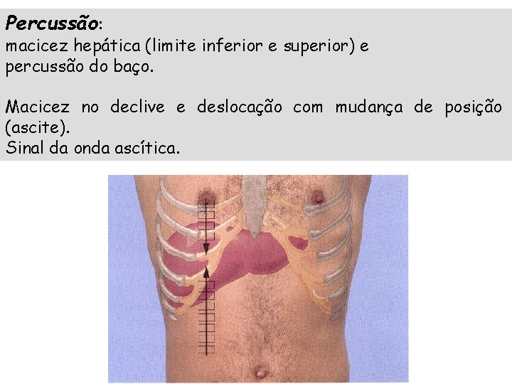 Percussão: macicez hepática (limite inferior e superior) e percussão do baço. Macicez no declive