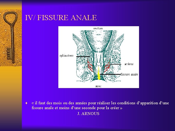 IV/ FISSURE ANALE ¨ « il faut des mois ou des années pour réaliser