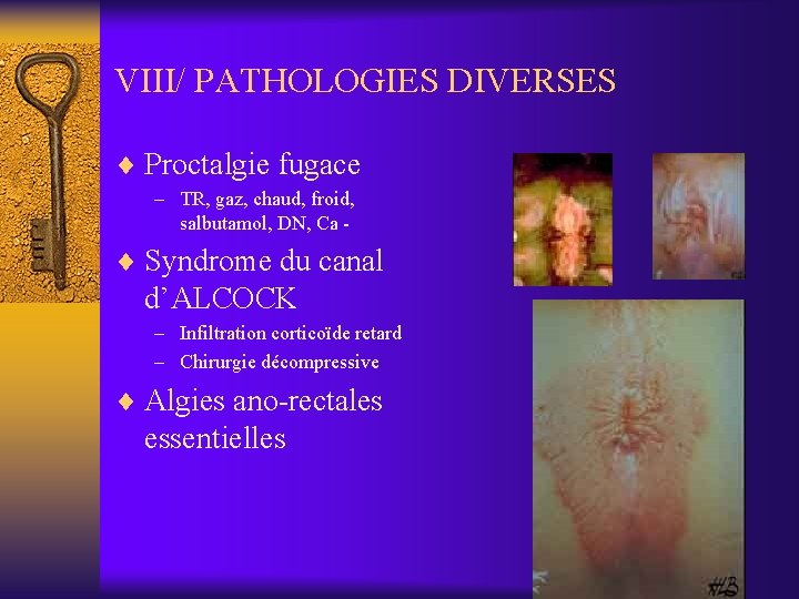 VIII/ PATHOLOGIES DIVERSES ¨ Proctalgie fugace – TR, gaz, chaud, froid, salbutamol, DN, Ca