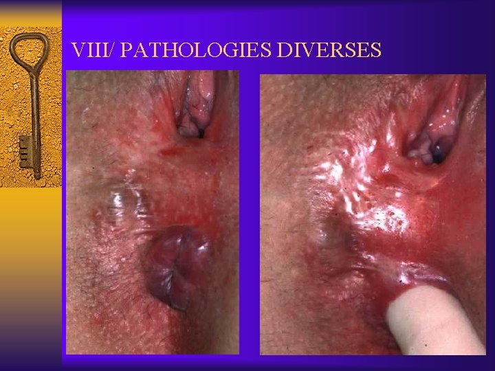 VIII/ PATHOLOGIES DIVERSES 