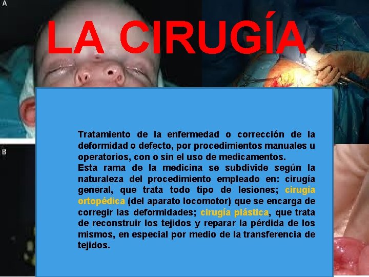 LA CIRUGÍA Tratamiento de la enfermedad o corrección de la deformidad o defecto, por