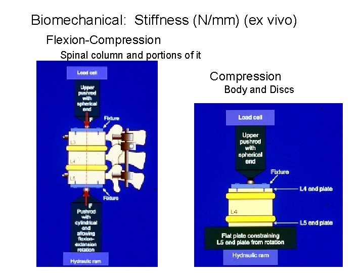 Biomechanical: Stiffness (N/mm) (ex vivo) Flexion-Compression Spinal column and portions of it Compression Body