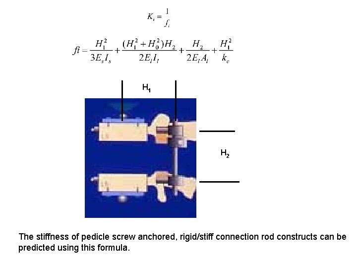 H 1 H 2 The stiffness of pedicle screw anchored, rigid/stiff connection rod constructs