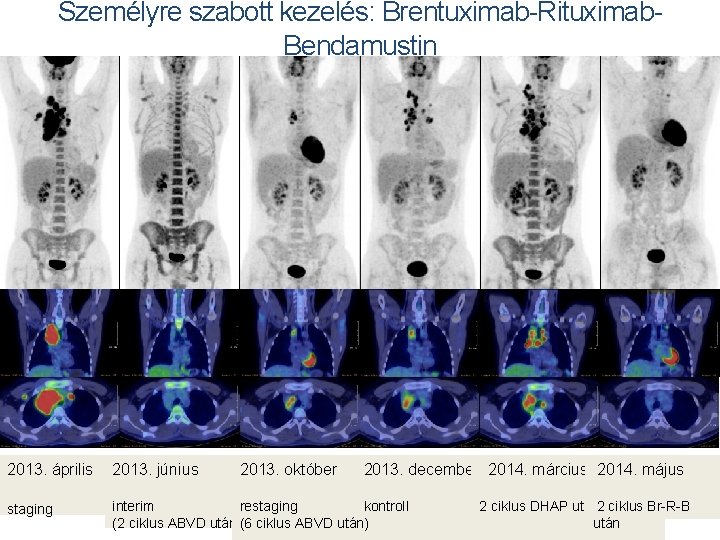 Klinikai Központ Reumatológiai és Immunológiai Klinika · PTE ÁOK