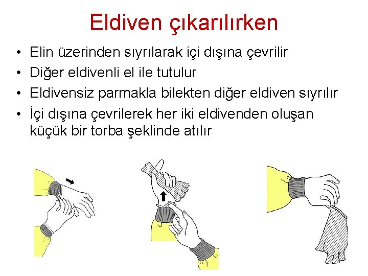 Eldiven çıkarılırken • • Elin üzerinden sıyrılarak içi dışına çevrilir Diğer eldivenli el ile