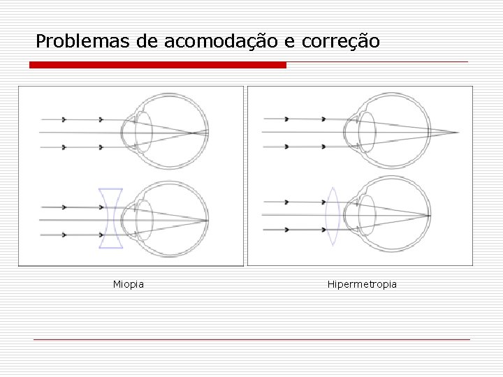 Problemas de acomodação e correção Miopia Hipermetropia 