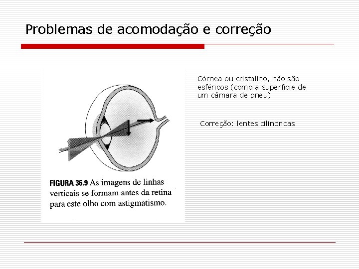 Problemas de acomodação e correção Córnea ou cristalino, não são esféricos (como a superfície