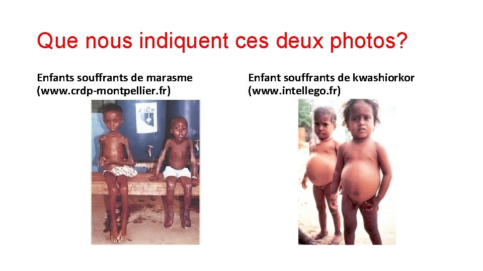 Que nous indiquent ces deux photos? Enfants souffrants de marasme (www. crdp-montpellier. fr) Enfant Que nous indiquent ces deux photos? Enfants souffrants de marasme (www. crdp-montpellier. fr) Enfant