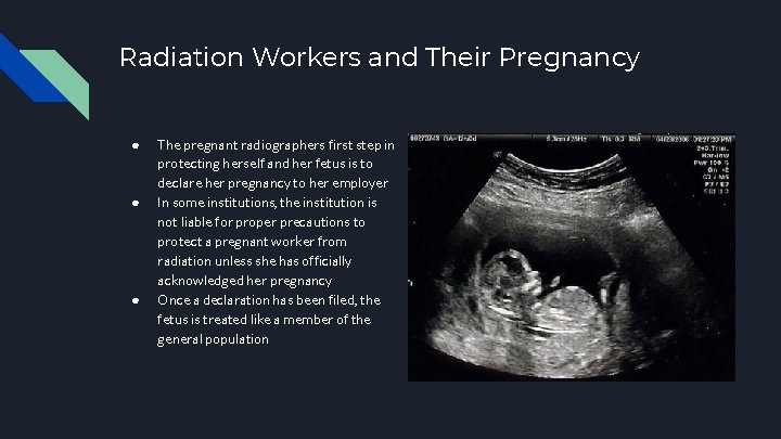 Radiation Workers and Their Pregnancy ● ● ● The pregnant radiographers first step in
