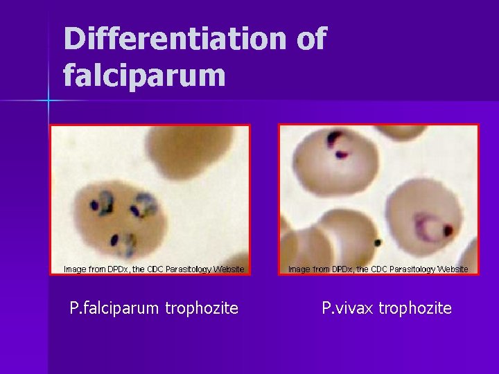 Differentiation of falciparum P. falciparum trophozite P. vivax trophozite 