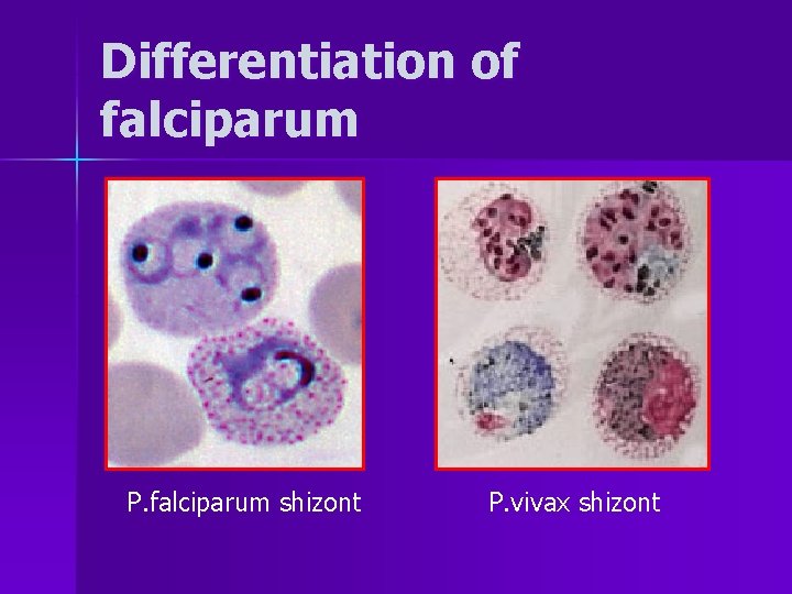 Differentiation of falciparum P. falciparum shizont P. vivax shizont 