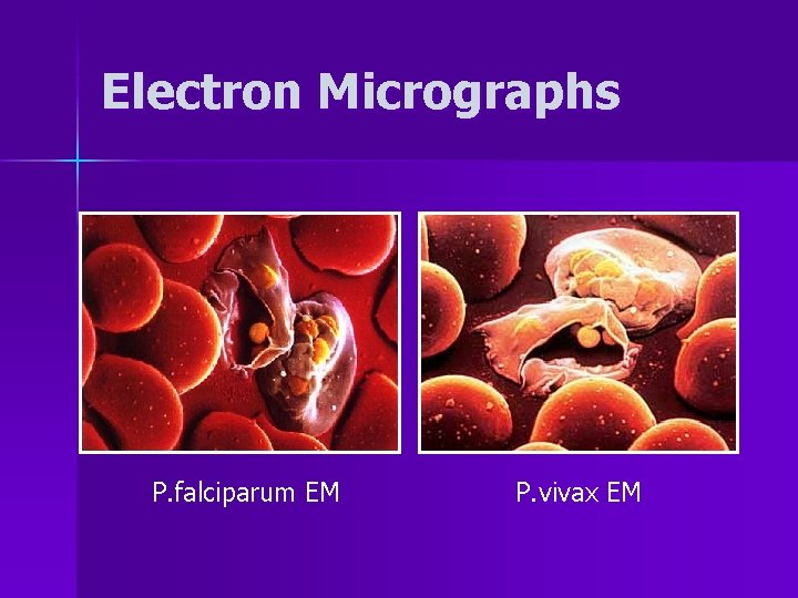 Electron Micrographs P. falciparum EM P. vivax EM 