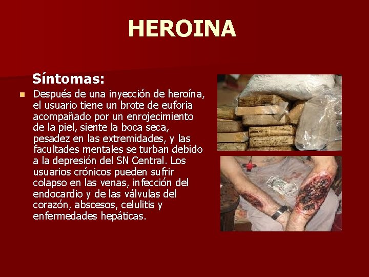 HEROINA Síntomas: n Después de una inyección de heroína, el usuario tiene un brote