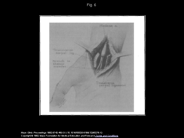 Fig. 6 Mayo Clinic Proceedings 1992 6742 -48 DOI: (10. 1016/S 0025 -6196(12)60278 -X)