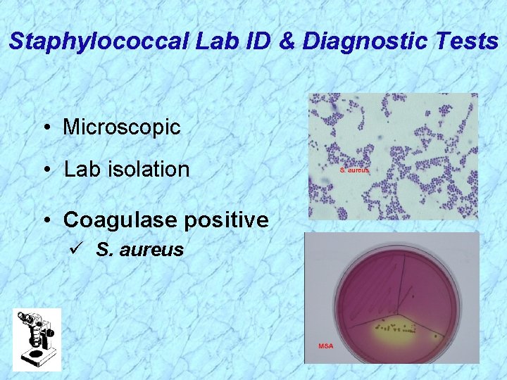 Staphylococcal Lab ID & Diagnostic Tests • Microscopic • Lab isolation • Coagulase positive