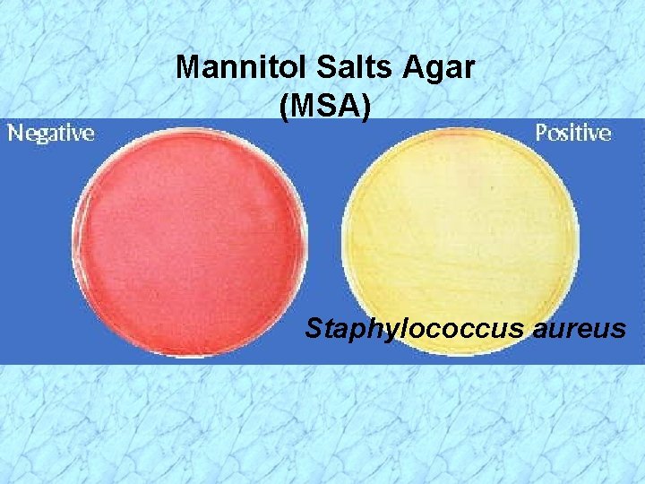 Mannitol Salts Agar (MSA) Staphylococcus aureus 