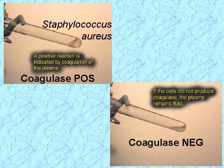 Staphylococcus aureus Coagulase POS Coagulase NEG 