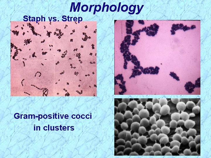 Morphology Staph vs. Strep Gram-positive cocci in clusters 