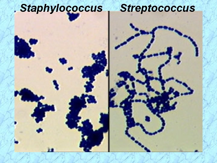 Staphylococcus Streptococcus 