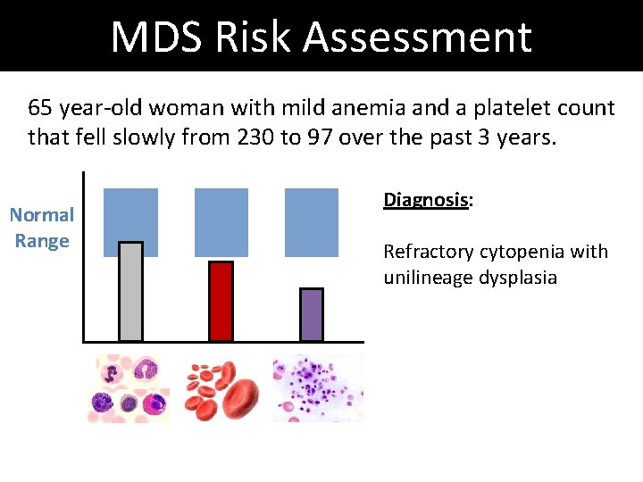 MDS Risk Assessment 65 year-old woman with mild anemia and a platelet count that