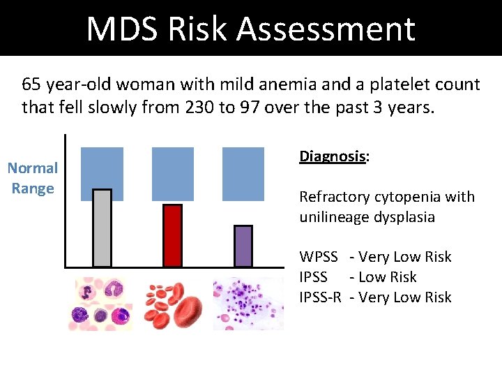 MDS Risk Assessment 65 year-old woman with mild anemia and a platelet count that