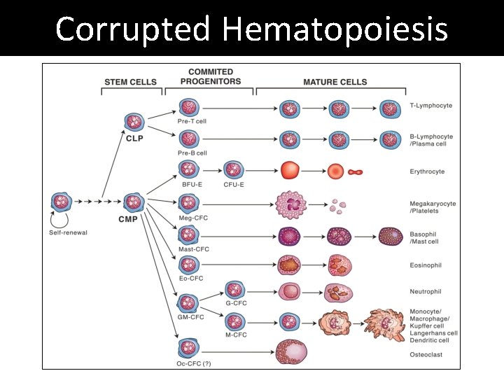 Corrupted Hematopoiesis 