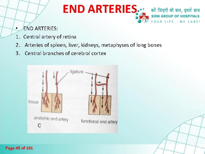 END ARTERIES • 1. 2. 3. END ARTERIES: Central artery of retina Arteries of