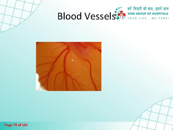 Blood Vessels Page 75 of 101 