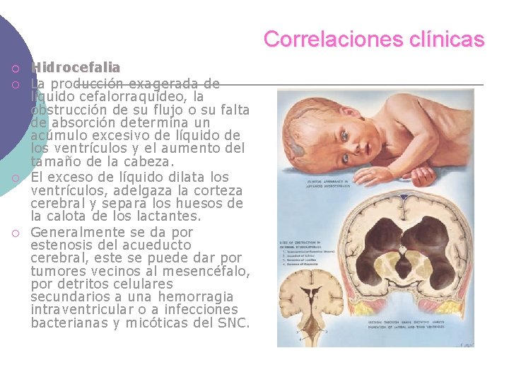 Correlaciones clínicas ¡ ¡ Hidrocefalia La producción exagerada de líquido cefalorraquídeo, la obstrucción de