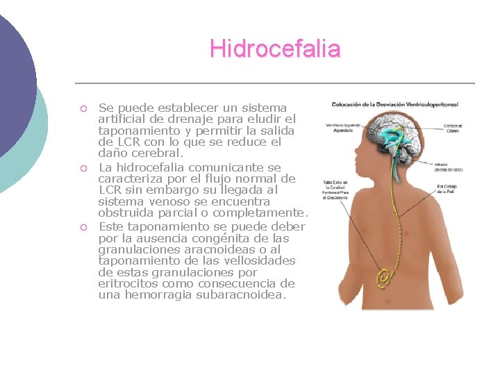 Hidrocefalia ¡ ¡ ¡ Se puede establecer un sistema artificial de drenaje para eludir