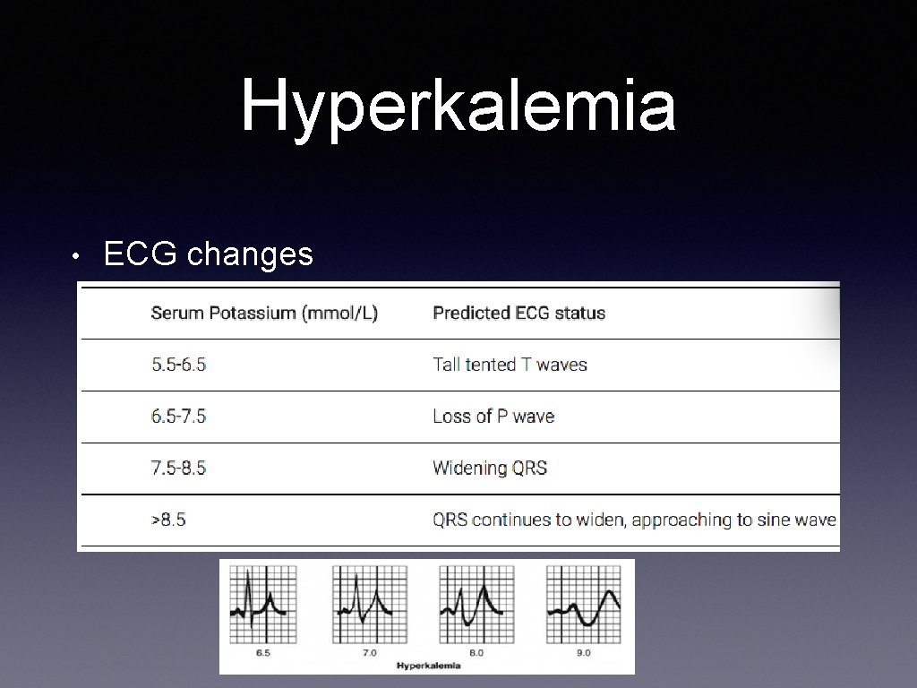 Hyperkalemia • ECG changes 