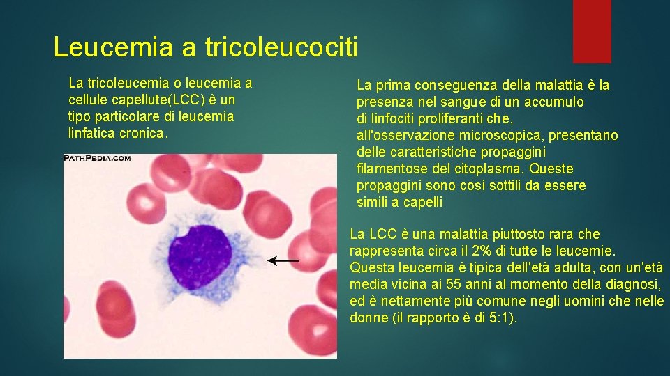 Leucemia a tricoleucociti La tricoleucemia o leucemia a cellule capellute(LCC) è un tipo particolare