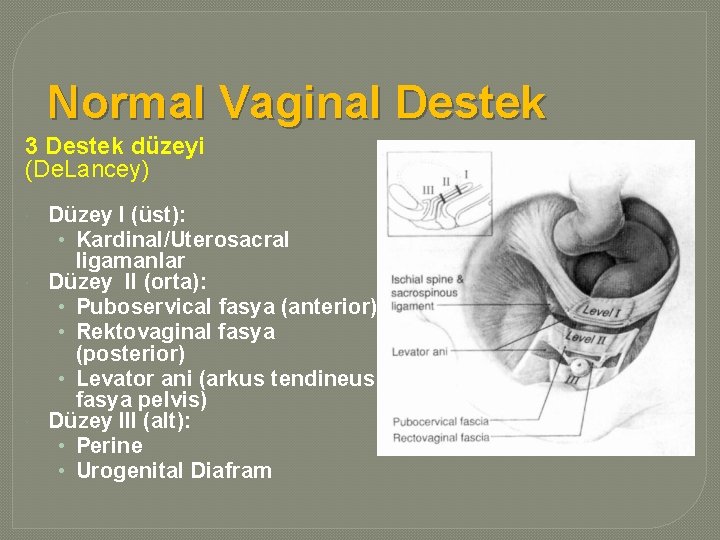 Normal Vaginal Destek 3 Destek düzeyi (De. Lancey) Düzey I (üst): • Kardinal/Uterosacral ligamanlar
