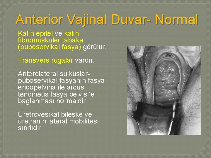 Anterior Vajinal Duvar- Normal Kalın epitel ve kalın fibromuskuler tabaka (puboservikal fasya) görülür. Transvers