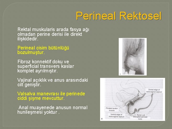 Perineal Rektosel Rektal muskularis arada fasya ağı olmadan perine derisi ile direkt ilişkidedir. Perineal