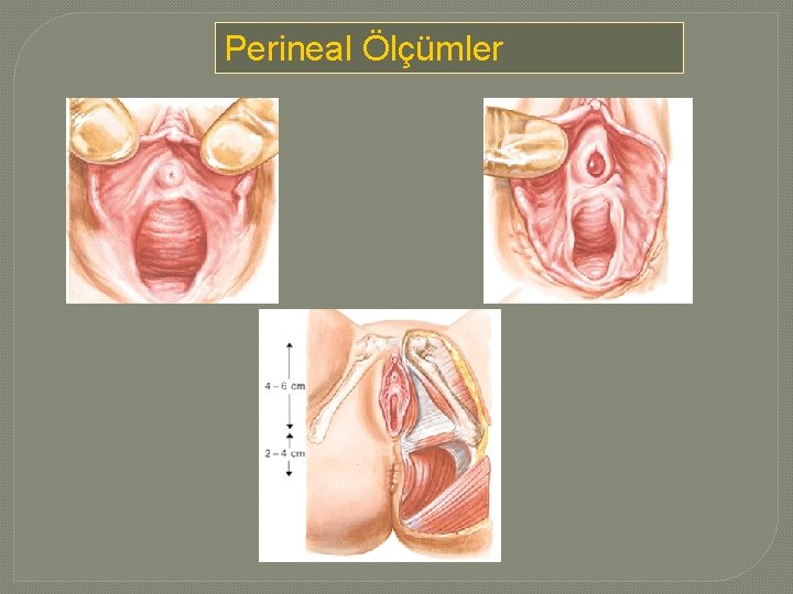 Perineal Ölçümler 