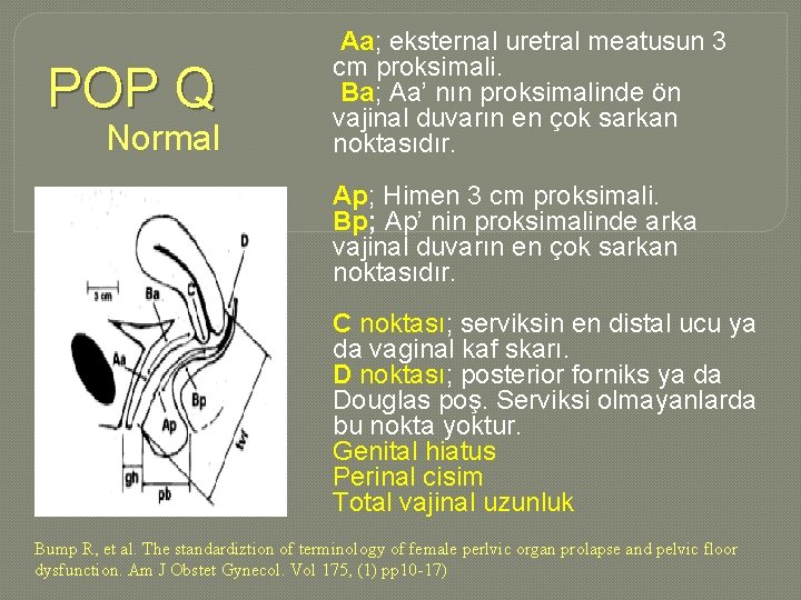 POP Q Normal Aa; eksternal uretral meatusun 3 cm proksimali. Ba; Aa’ nın proksimalinde