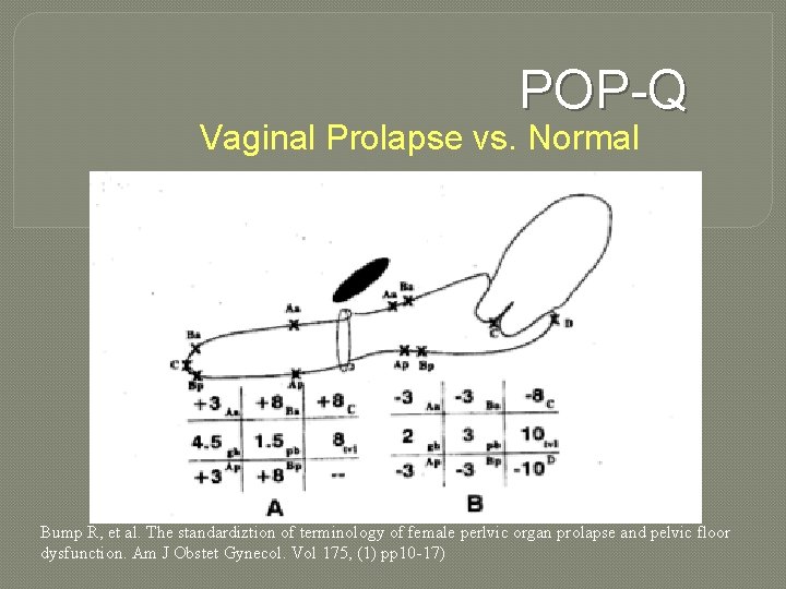 POP-Q Vaginal Prolapse vs. Normal Bump R, et al. The standardiztion of terminology of POP-Q Vaginal Prolapse vs. Normal Bump R, et al. The standardiztion of terminology of