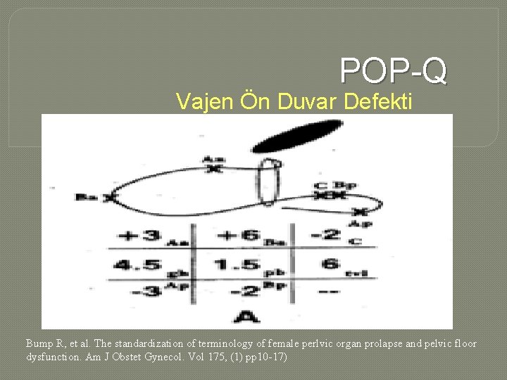 POP-Q Vajen Ön Duvar Defekti Bump R, et al. The standardization of terminology of POP-Q Vajen Ön Duvar Defekti Bump R, et al. The standardization of terminology of